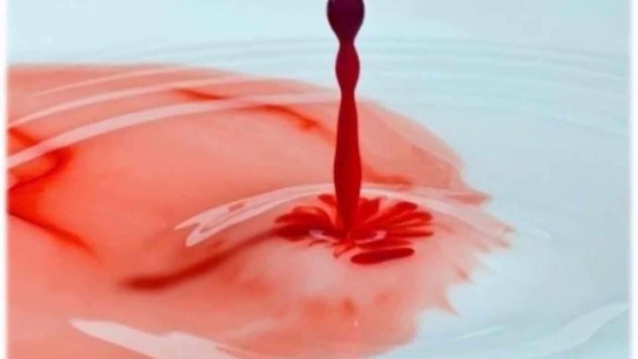 krwawe wydzieliny z penisa